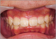 �L�b�Y���C���Ǘ�1