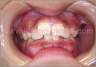 �L�b�Y���C���Ǘ�1