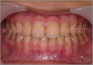 �L�b�Y���C���Ǘ�2