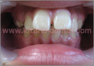 �L�b�Y���C���Ǘ�3